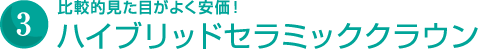 ハイブリッドセラミッククラウン　比較的見た目がよく安価！