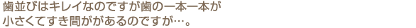 歯並びはキレイなのですが歯の一本一本が小さくてすき間ががあるのですが…。