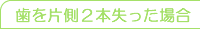 歯を片側2本失った場合
