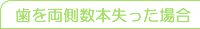 歯を両側数本失った場合